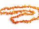 Le collier d’ambre : utile pour la douleur des poussées dentaires ?